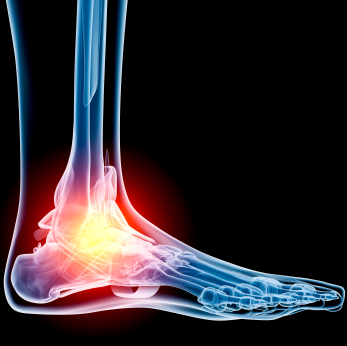 Systemic Diseases of the Foot