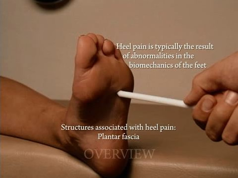 heel pain doctor